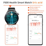 2025 New 1.55-Inch Smart Watch – Bluetooth Fitness Tracker, Heart Rate & Sleep Monitor, Waterproof Sports Smartwatch for Android & iOS